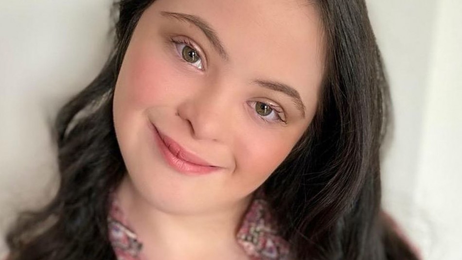 modelo sindrome down gucci