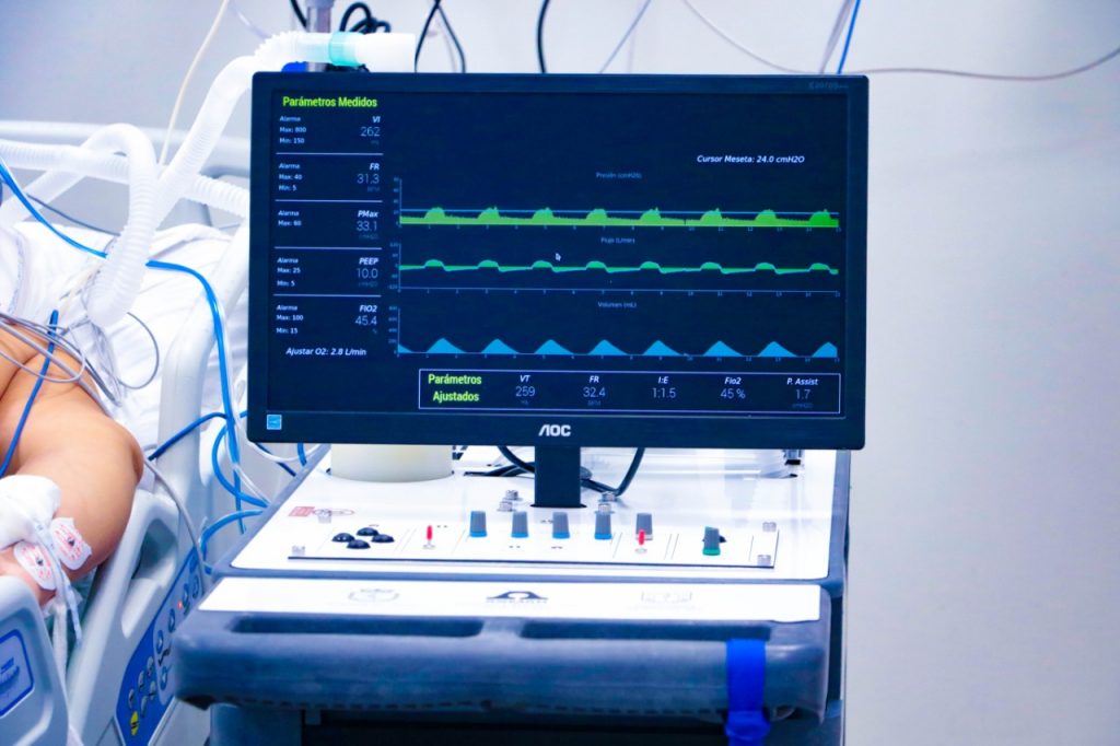 Fotografía: Prototipo Ventilador Asmar-UdeC