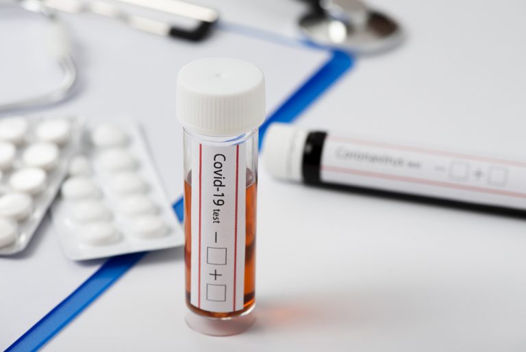 casos de coronavirus