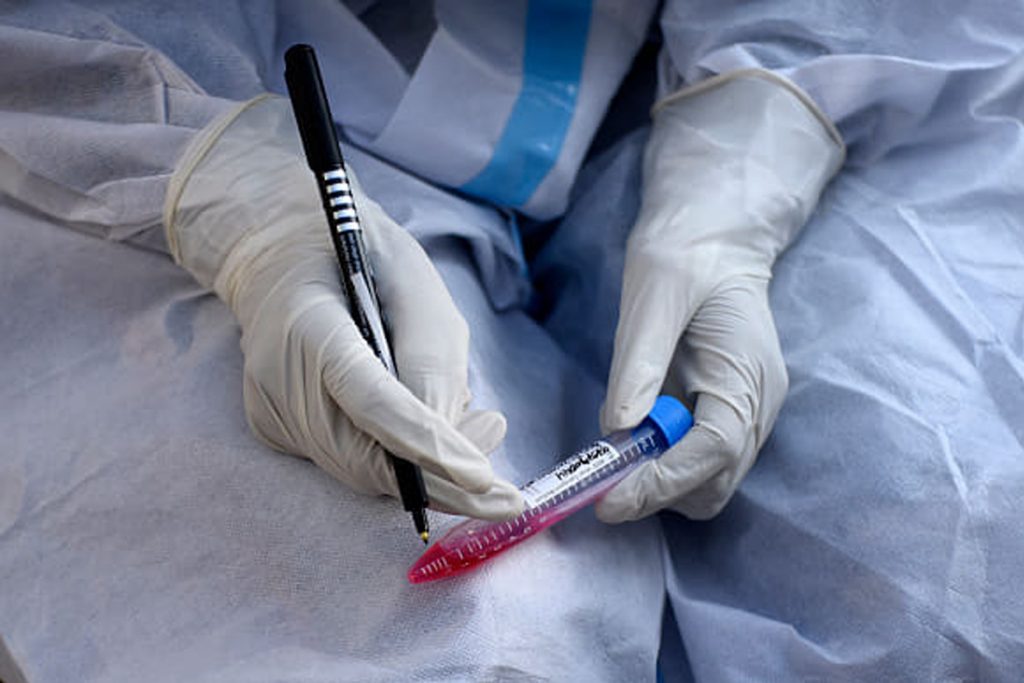 casos de coronavirus