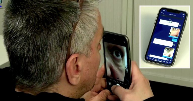 detectar examen coronavirus ojos