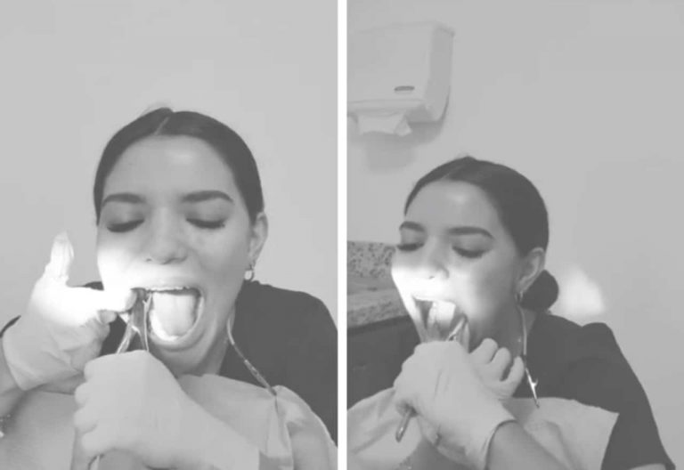 dentista se extrae saca sus propias muelas del juicio consulta sangra sagro dolor cantidad de se hizo viral en redes sociales twitter instagram facebook