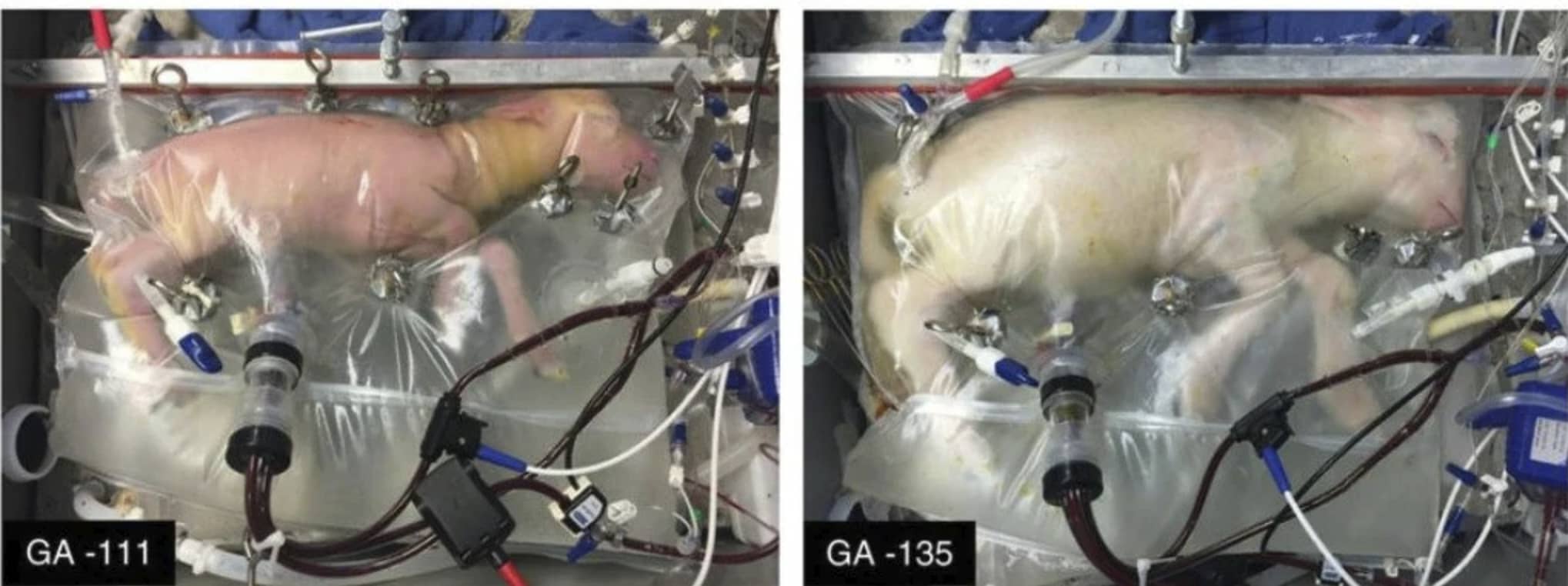 Researchers Have Successfully Grown Premature Lambs In An Artificial Womb
