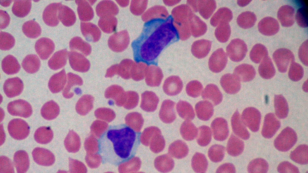 Esclerosis múltiple virus