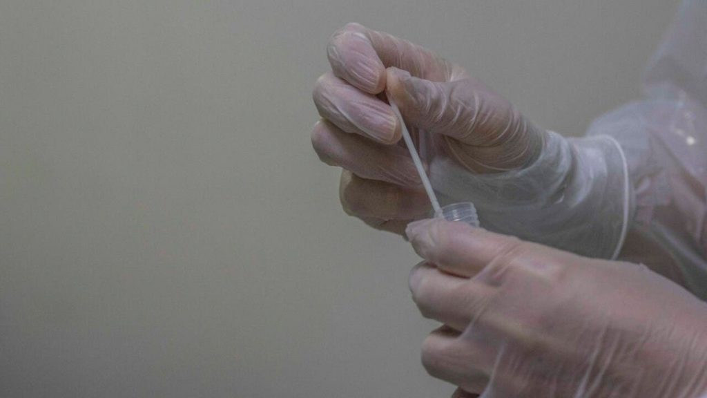 alerta sanitaria viruela del mono