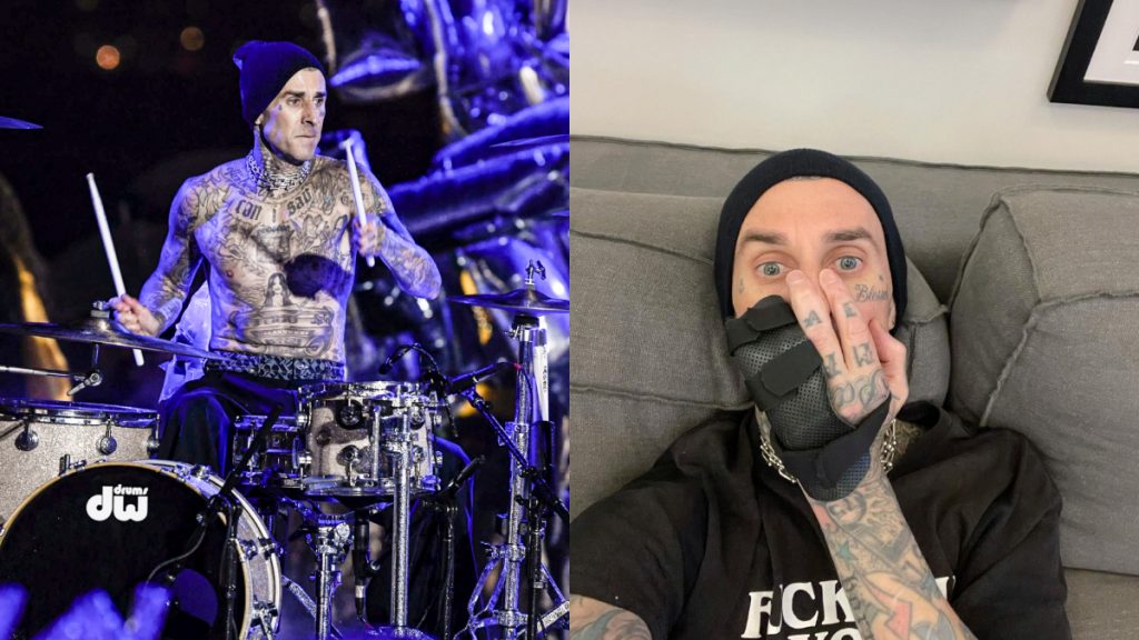 Travis Barker cirugía