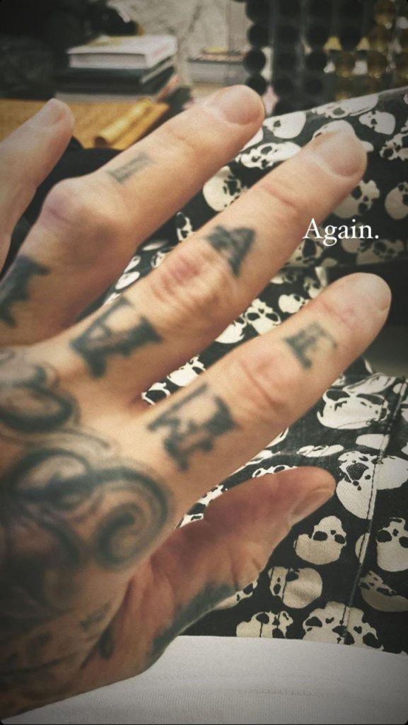 Travis Barker dedo fractura Blink-182