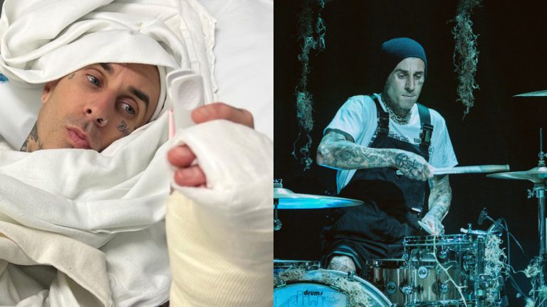 Blink-182 Travis Barker lesión