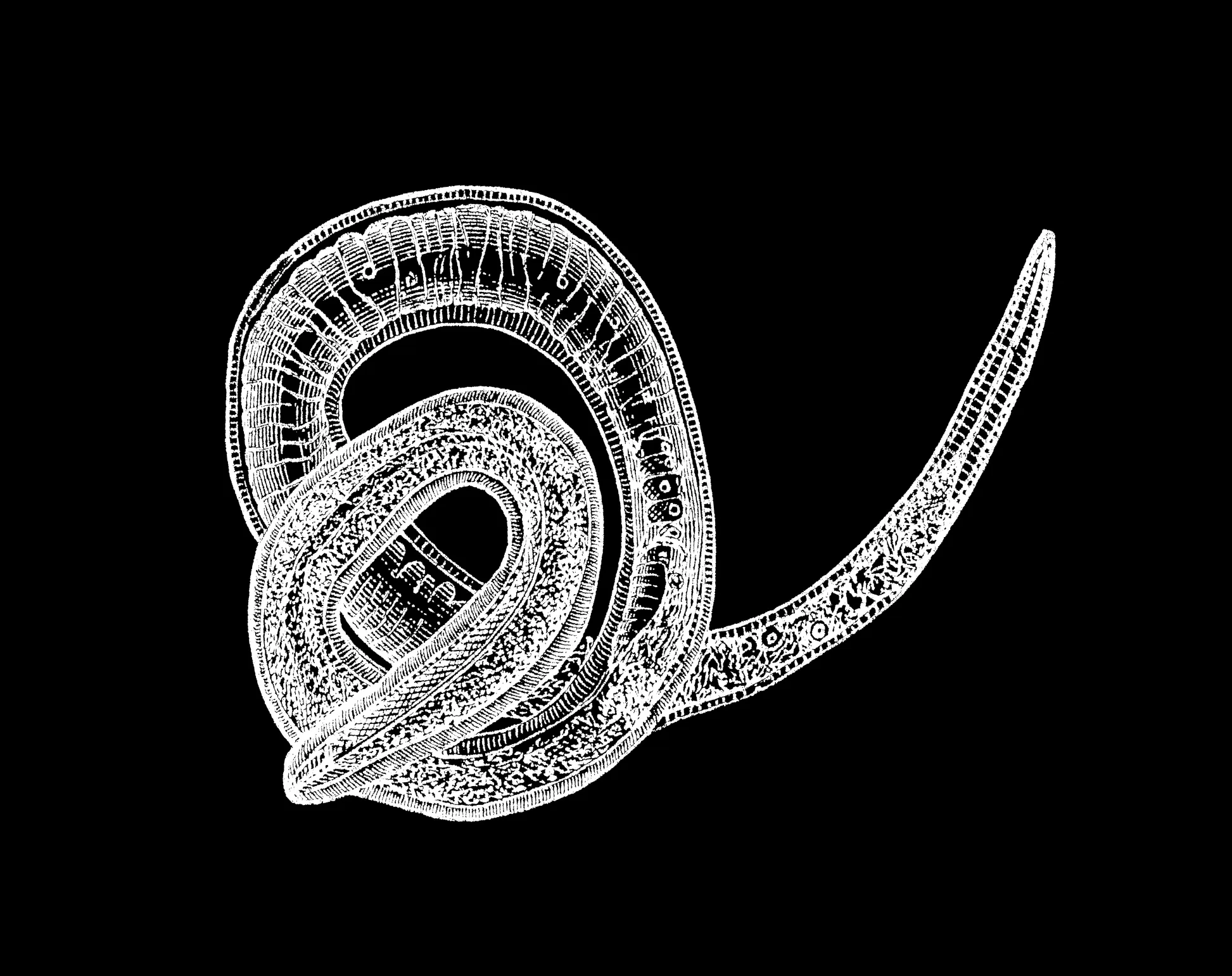 Triquinosis