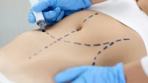 Bono Pad Abdominoplastía (2)